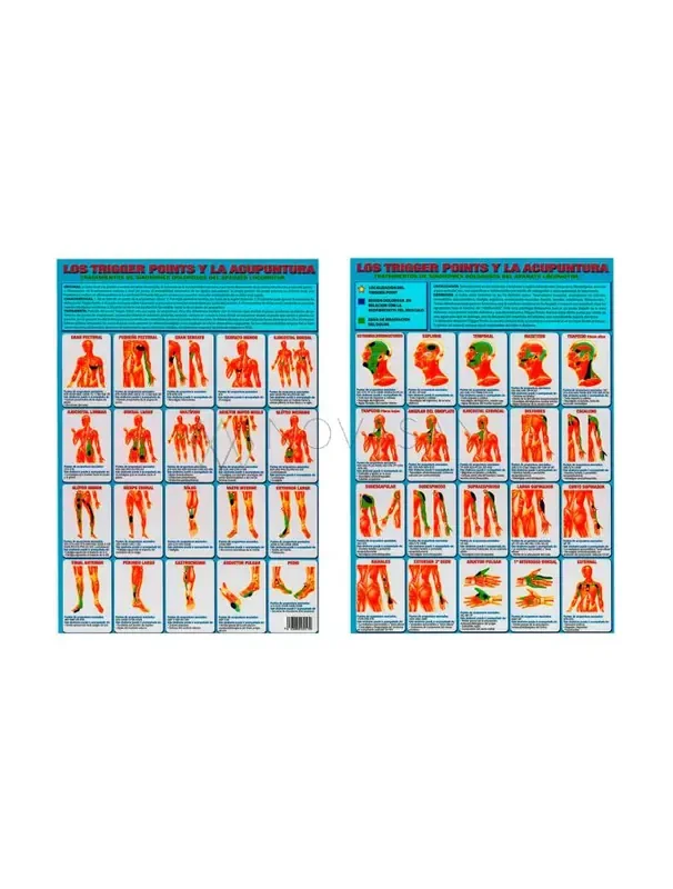 Trigger points y acupuntura